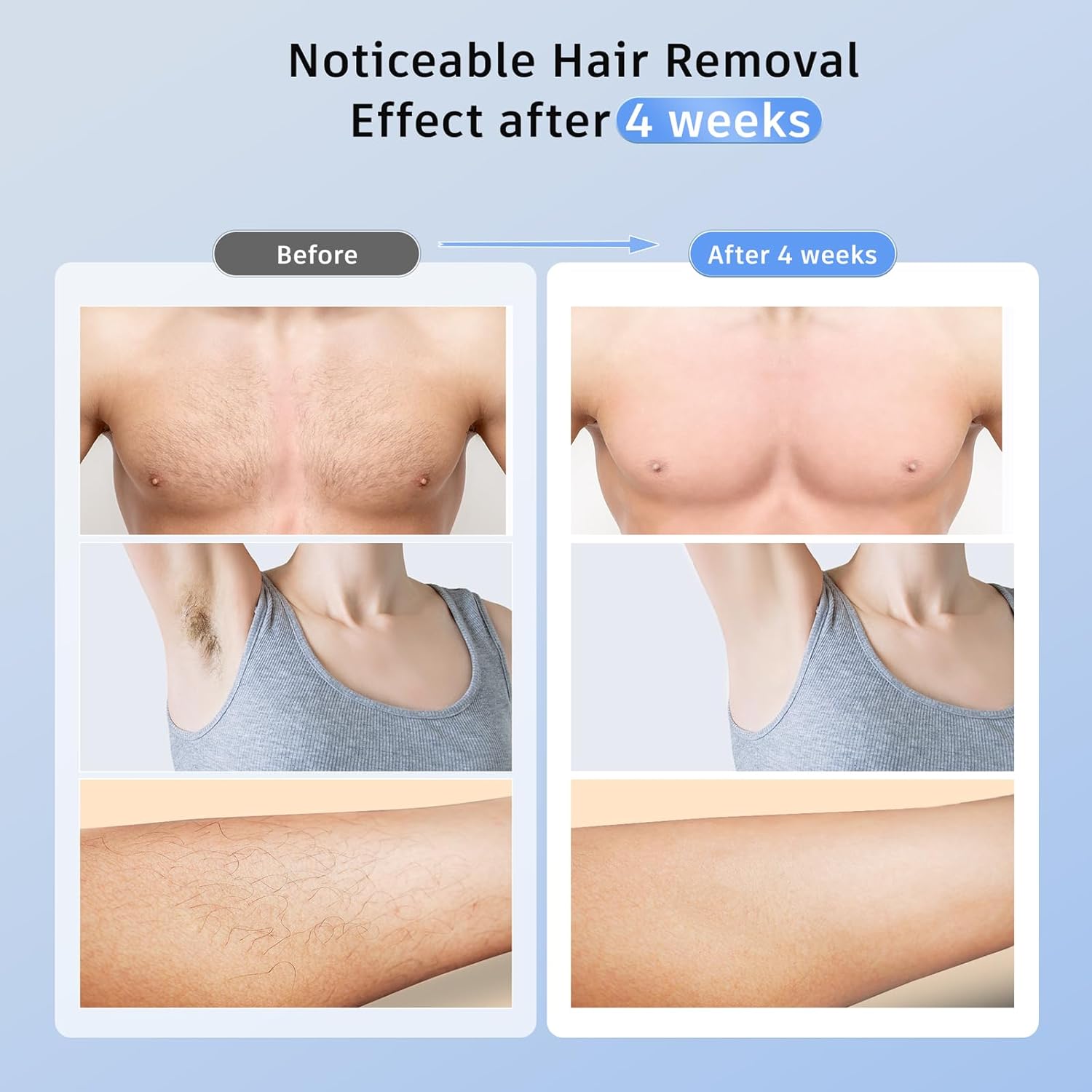 Ubroo IPL Hair Removal Device for Face and Body Treatments